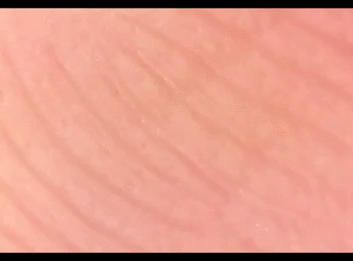 Pirkstu galu sviedru... Autors: Moonwalker Ikdienas priekšmeti manā mikroskopā 3. daļa