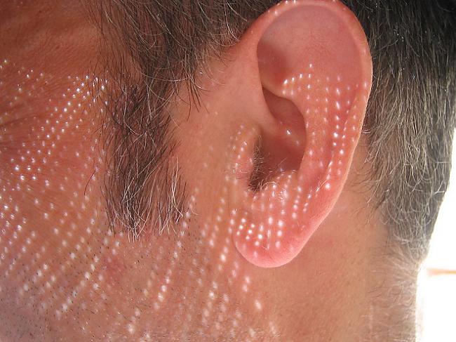 Tavas ārējās auss forma var... Autors: Geimeris Fakti par cilvēka ķermeni!