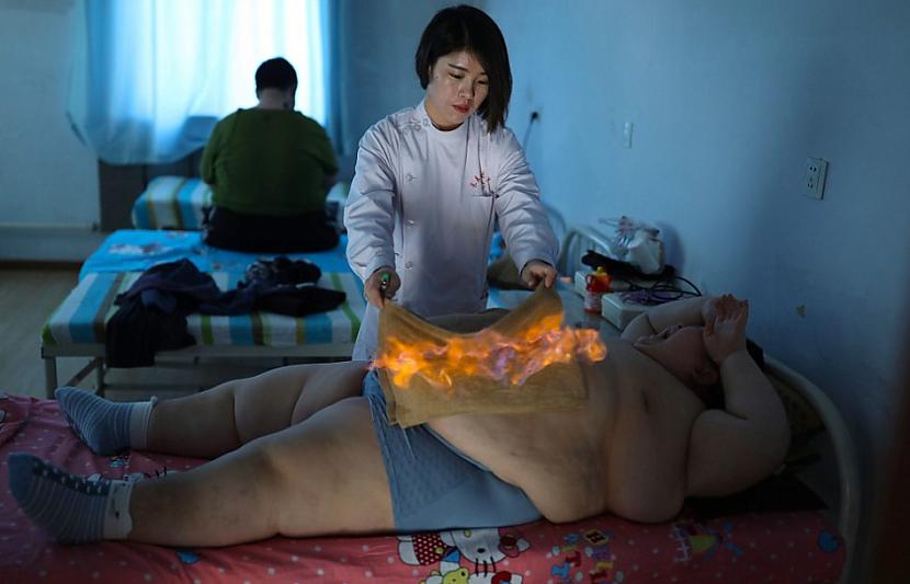 Atmetot ar roku visai... Autors: matilde 150kg smagais bērns cenšas zaudēt svaru ar uguns palīdzību