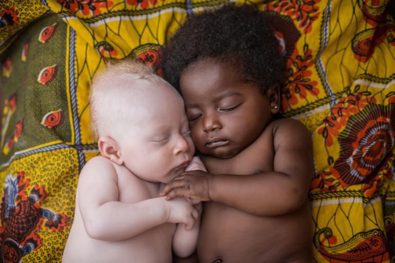 3 nedēļu vecs albīnu mazulis... Autors: 100 A 35 emocionālas planētas iedzīvotāju bildes. Cilvēki ir tik dažādi