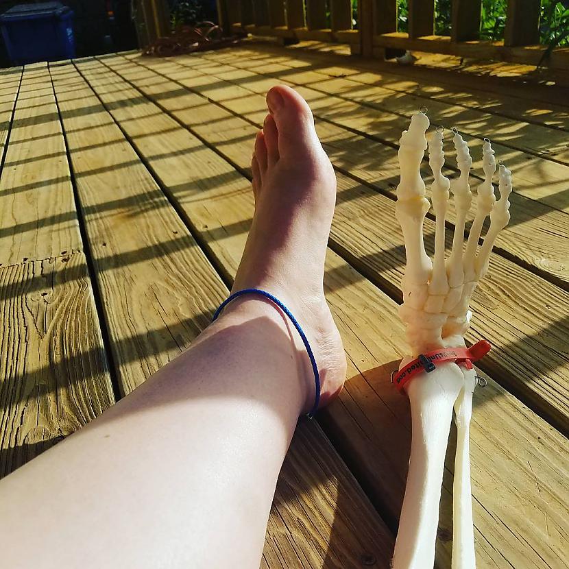 2016 gada aprīlī Kristijai... Autors: matilde Amerikānietes Instagram profils vēsta par piedzīvojumiem ar amputētu kāju