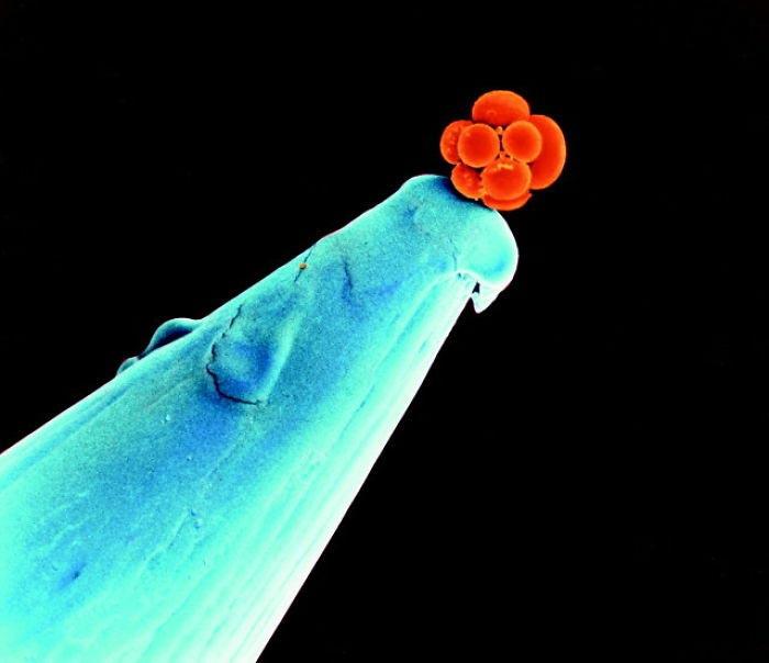 Cilvēka embrijs agrīnā stadijā... Autors: matilde No cita skatupunkta: 28 attēli ar to, ko mēs parasti neredzam