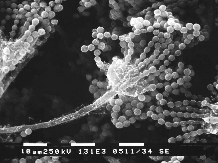 Kas ir vēl pārsteidzoscaronāk... Autors: Lestets Kas notiktu, ja uz Zemes pazustu visi mikrobi?