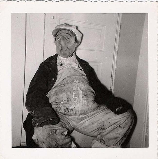 Vīrieties ar dīvainu slimību... Autors: Lestets Laikam dīvainākās vēsturiskās fotogrāfijas, kas ir uzņemtas