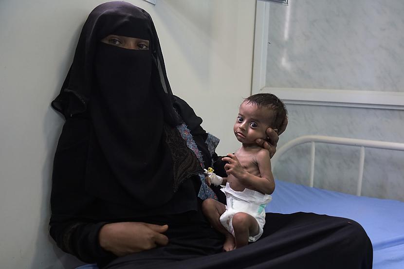 Mazāk kā 50 no medicīnas... Autors: Spaik Jemenas pilsoņu karš – lielākā humānā krīze 21. gadsimtā!