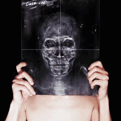 Kurscaron no retgeniem tev... Autors: The Diāna 12 pārsteidzoši rentgeni, kuri liks uz pasauli raudzīties citādāk
