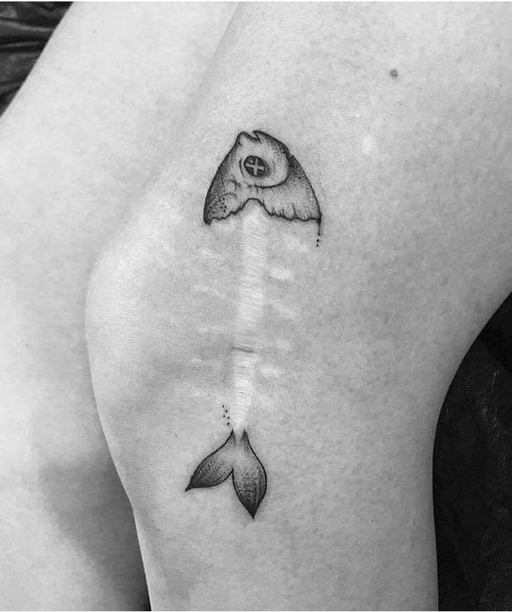 Lieliska ideja tam kā... Autors: The Diāna 20 brīnišķīgi tetovējumi, kuri piesedz ķermeņa nepilnības un rētas