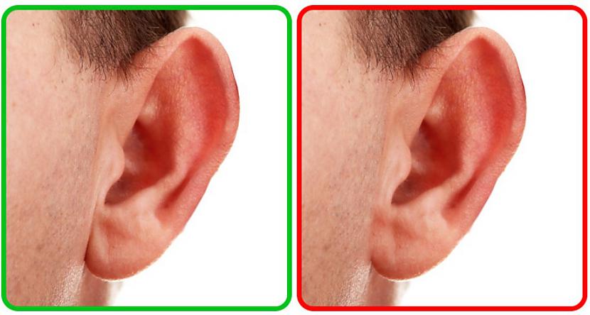 Nesimetriskas ausisCilvēki... Autors: The Diāna Ķermeņa pazīmes, kuras liecina par cilvēka inteliģenci