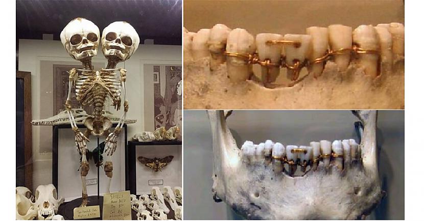  Autors: The Diāna Izglītojoši: Neparasti skeleti, kuri ilustrē slimības un procesus