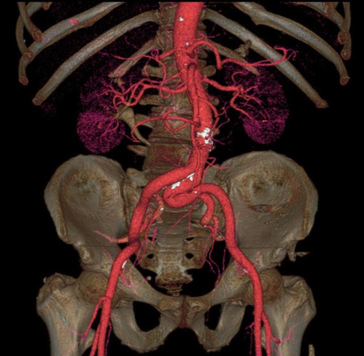 Aorta ir ķermeņa lielākā... Autors: Lestets 15 rentgenuzņēmumi, kas atklās par ķermeni vairāk nekā anatomijas grāmatas