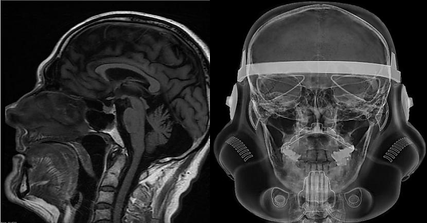  Autors: Lestets 15 rentgenuzņēmumi, kas atklās par ķermeni vairāk nekā anatomijas grāmatas