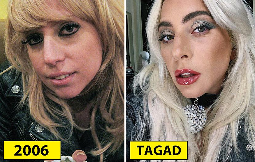 Lēdija Gaga Autors: matilde Kā izskatījās aktieri savas karjeras sākumā un kā viņi izskatās tagad