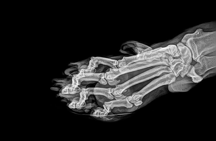 Tīģera ķepas rentgenuzņēmums... Autors: Lestets 15 rentgenuzņēmumi, kas ļauj ielūkoties dzīves apslēptajās pusēs