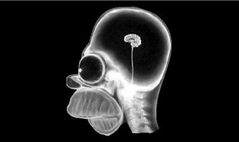 Humoram Homēra Simpsona... Autors: The Diāna 18 forši rentgeni redzesloka paplašināšanai