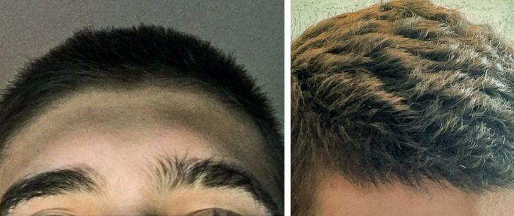 quotMani mati pirms un pēc... Autors: Lestets 15 pārsteidzošas cilvēka ķermeņa īpatnības