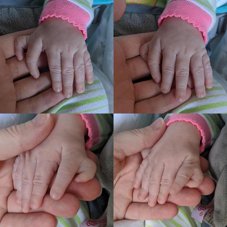 Bērns kura abām rokām ir pa... Autors: Lestets 19 reizes, kad daba mūs pārsteidza ar kaut ko īpašu