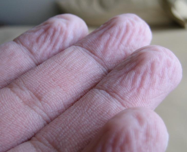 Grumbuļaini pirkstiJa mēs... Autors: Lestets 7 pārsteidzoši fakti par mūsu ķermeni
